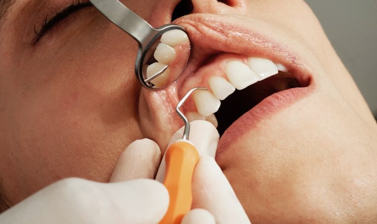dental implants epping